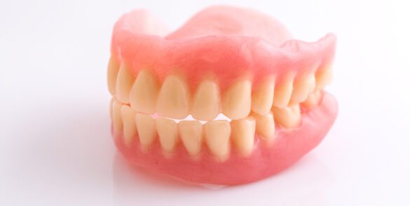 Darstellung zum Thema zahnbehandlung – budapest – zahnimplantate – bavaria – dental bei Bavaria Dental Budapest