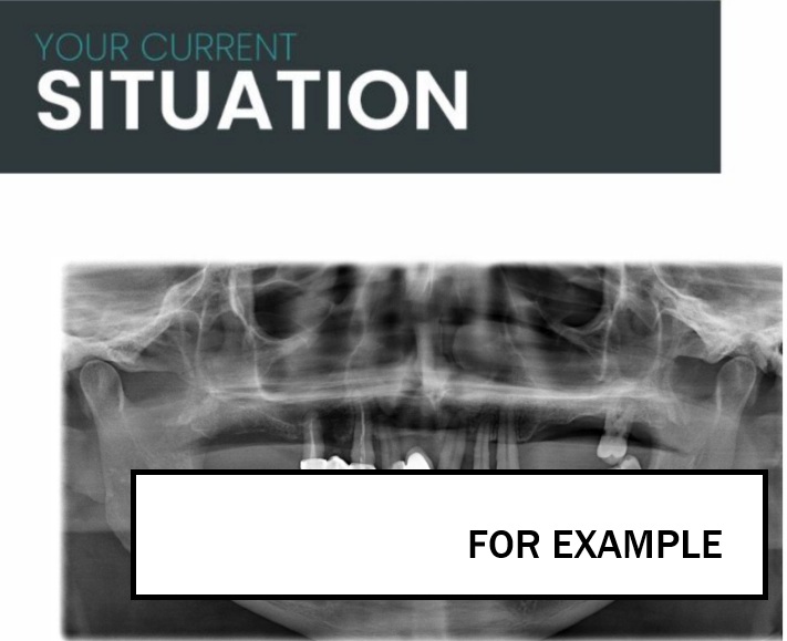 If you have received a treatment plan in the UK or elsewhere, we offer a free professional review and comparison