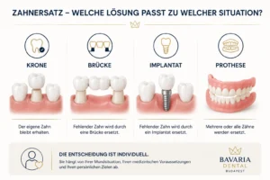 Zahnersatz im Vergleich: Krone, Brücke, Implantat und Prothese